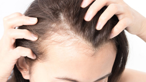 What Women Should Do About Thinning Hair