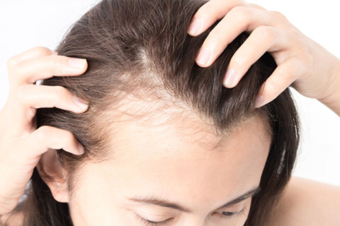 What Women Should Do About Thinning Hair